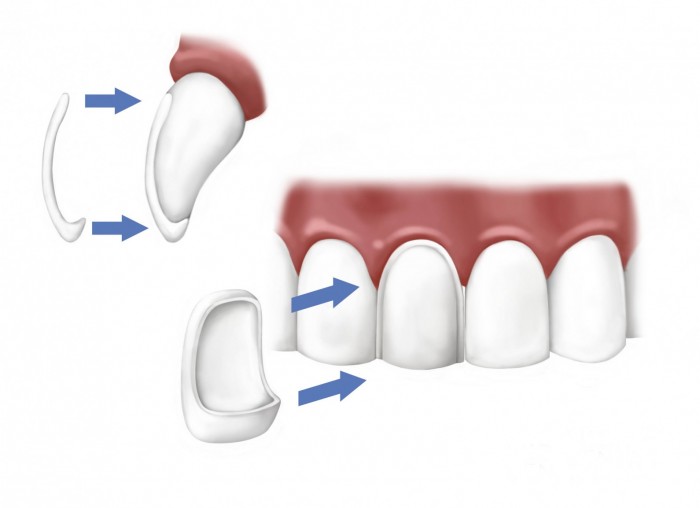 fatete dentare